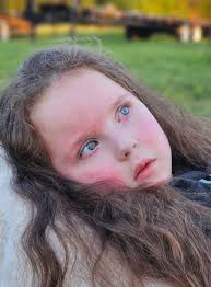 Laramies Journey With Infantile neuroaxonal dystrophy (INAD)