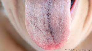 Somos la cuenta oficial en twitter de cnn chile #vamosmásallá. Ù„Ø³Ø§Ù† ÙƒÙˆØ±ÙˆÙ†Ø§ Ø¹Ø§Ø±Ø¶ Ø¬Ø¯ÙŠØ¯ Ù„ÙƒÙˆÙÙŠØ¯ 19 ØµØ­Ø© Ù…Ø¹Ù„ÙˆÙ…Ø§Øª Ù„Ø§ Ø¨Ø¯ Ù…Ù†Ù‡Ø§ Ù„ØµØ­Ø© Ø£ÙØ¶Ù„ Dw 18 01 2021