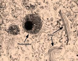 Peroxisomes Play A Role In Metabolism Through Oxidation Plant Cells Do Not Have Lysosomes So Peroxisomes Teaching Biology General Knowledge Facts Plant Cell