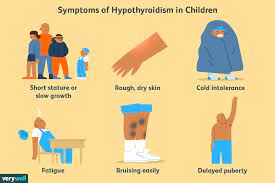 • if the circulation levels of t3 and t4 are high then pituitary gland decreases its sensitivity to tsh. Symptoms Of Thyroid Disease In Children