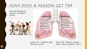 It's a contagious infection that can be spread in the. Online Essay Help Amazonia Fiocruz Br
