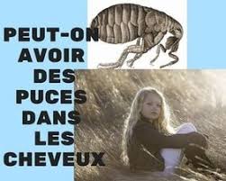 Je veux trouver du matériel et équipements pour mes animaux pas cher ici comment repousser les puces. Peut On Avoir Des Puces Dans Les Cheveux Lesnuisibles Com