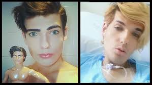 Real Life Ken Doll DEAD...Cancer Kills Him At Age 20
