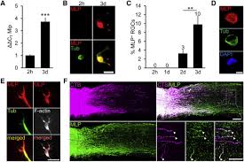 Jh lee, hj lee, sy lim, bg kim, jw choi. Muscle Lim Protein Is Expressed In The Injured Adult Cns And Promotes Axon Regeneration Sciencedirect