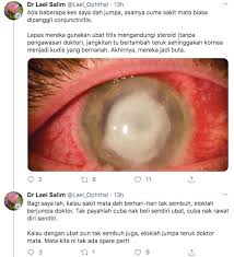 Semua hadiah dari nyamuk jahanam. Selamatkah Ubat Titis Mata Anda Ini Penjelasan Doktor Yang Perlu Anda Ambil Tahu