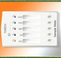 TORCH IgM and TORCH IgG Screening Tests – Ivd Rapid Tests