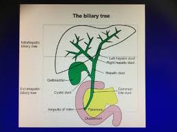 Causes of air in the biliary tree (pneumobilia) by editorial team / february 26, 2021 may 31, 2021 / medicine , mnemonics , surgery , usmle remember the causes of air in the biliary tree / pneumobilia using the mnemonic persepolis. Biliary Tree Flashcards Quizlet