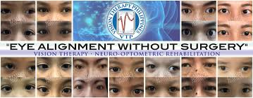 Usc roski eye institute contact us. Vision Therapy Philippines At Vision Science Institute Home Facebook