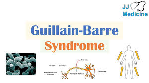 Guillain Barre Syndrome Gbs Causes Pathophysiology Signs Symptoms Diagnosis Treatment Youtube