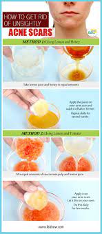 Entdecke rezepte, einrichtungsideen, stilinterpretationen und andere ideen zum ausprobieren. Pin On Make Up Face Hacks