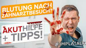 Blutung Nach Zahnarztbesuch Oder Op Akuttipps Was Tun Wann Zum Arzt Youtube