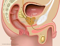 Lower Urinary Tract Obstruction Luto Children S Minnesota