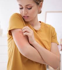 Does hand sanitizer kill ringworm : Home Remedies For Ringworms 10 Ways To Treat The Symptoms