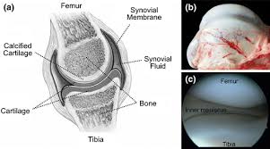 We did not find results for: Cartilage Tissue Engineering And Bioreactor Systems For The Cultivation And Stimulation Of Chondrocytes Springerlink