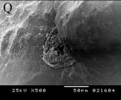 Image result for Trigonella anguina