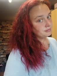 Where can I get starter kit ?