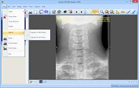 It only runs on mac os, version 10.8 or higher. Download Sante Dicom Viewer Free 6 0