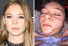 Tina fey long remained mum on the cause of the faint but visible scar on the left side of her face. Taylor Hickson Sues Producers Over Disfiguring Facial Injury On Ghostland Set Deadline