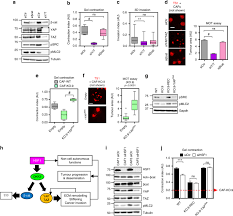 Kill 1 den watcher, 2 ursas, 10 totemics, and 12 warriors of the foulweald tribe, and then return to raene wolfrunner in astranaar. Dickkopf 3 Links Hsf1 And Yap Taz Signalling To Control Aggressive Behaviours In Cancer Associated Fibroblasts Nature Communications