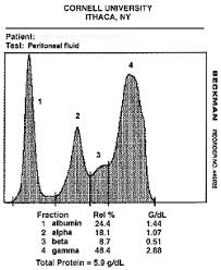 Multiple myeloma (mm) is a debilitating malignancy that is part of a spectrum of diseases ranging bone marrow aspirate demonstrating plasma cells of multiple myeloma. Total Protein Electrophoresis Cornell University College Of Veterinary Medicine