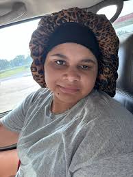 Brutal honesty. How noticable is my facial drooping? Last photo is before,  others are after. I got confirmation that it's not a stroke, but multiple  sclerosis