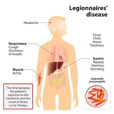 What Is Legionnaires Disease Disease Muscle Aches Chronic Obstructive Pulmonary Disease
