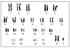 É o objetivo da gestalt de determinar a natureza de tais conjuntos (1924). Questoes De Biologia Mutacoes E Alteracoes Cromossomicas Para Concurso Qconcursos Com