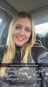 My braces journey #braces #adultbraces #24 #momsoftiktok