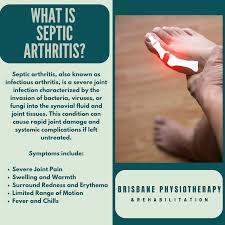 Image result for Septic Joint