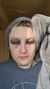 it always looks way worse than it actually is