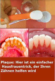 Plaque Here S A Simple Housewife S Trick That Will Help Your Teeth Craft Zahne Gesundheit Hausfrau