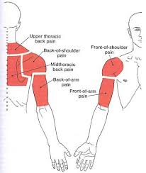 With the right shoulder exercises, you can rebuild your shoulder strength, flexibility, and control for shoulder pain is extremely common, with estimates of up to 70% of people affected over the course of their lifetimes. Shoulder Pain