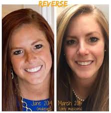 Check out Emily Ochs. She looked great before with the freckles, but now  look at her