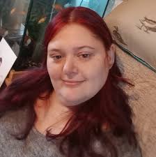 Raynaud's Phenomenon/Disease Affects Fingers and Toes! Image credit:  Molly's Fund Fighting Lupus  https://www.facebook.com/MentalHealthandInvisibleIllnessResources/ ~ Mental  Health and Invisible Illness Resources ♥ https://www.facebook.com ...