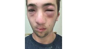 Morrer tentando ser aceito: os estudantes que morrem nas cerimônias de  fraternidades nos EUA