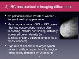 Inflammatory breast carcinoma is a rare type of invasive ductal carcinoma, which mimics an infection or mastitis at presentation. Inflammatory Breast Cancer Ibc Information