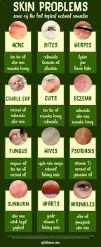 Psoriasis Diet Natural Remedies For Skin Problems Infographic Real People Real Results 160 Natural Psoriasis Remedies Psoriasis Remedies Natural Remedies