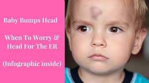 Baby Bumps Head When To Worry Head For The Er Infographic Baby Bumped Head Toddler Head Injury Children Hitting