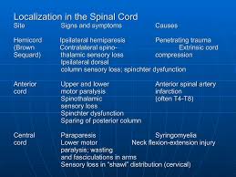 Image result for Neurologic Lesion Localization