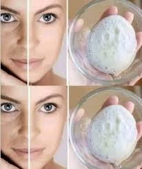 Baking Soda Remedy for Age Spots, Acne, and Blackheads