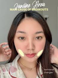 18 top Pimple Map ideas in 2024