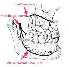 Can T Get Numb What To Do If Dental Injections Don T Work