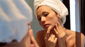 Your Search For the Best Acne Treatments in Dallas Stops Here