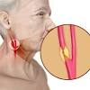 One carotid artery is located on each side of your neck. 1