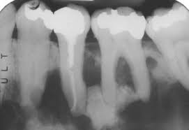Serum carotenoids and vitamins and risk of cervical dysplasia. 16 Nonodontogenic Intraosseous Lesions Pocket Dentistry