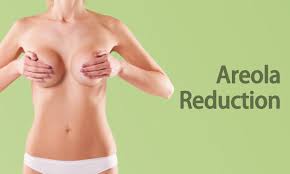 This procedure may leave a small scar around the areola. Areola Reduction Breast Surgery In Surat Gujarat India