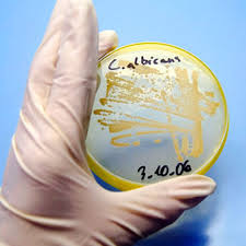 What are vaginal yeast infections? Vaginal Yeast Infection Symptoms Treatments Home Remedies Causes