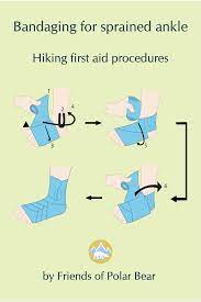 First Aid Ankle Bandaging Sprained Ankle Sprain Bandage