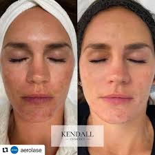 Jim Spivey (@jspivey_aesthetics) · Instagram 照片和视频