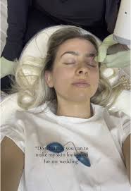 New Face Laser for 2025